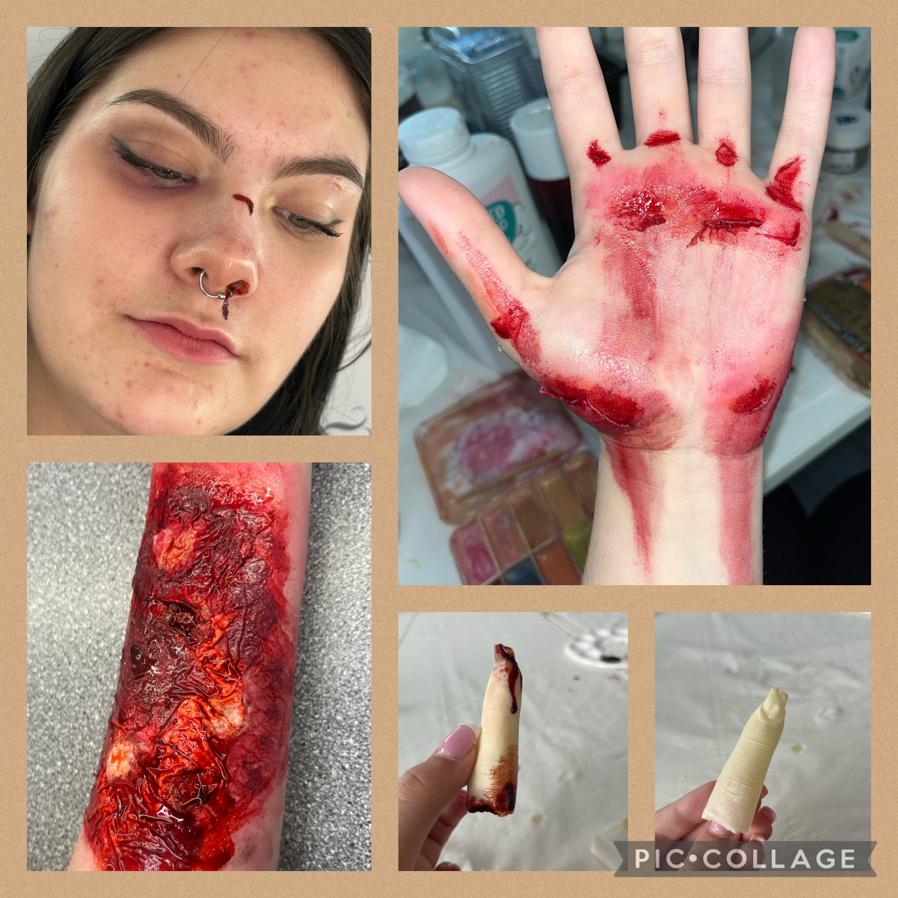 Severed finger/bruised eye/broken nose/burned forearm/grazed hand all created during Level 3 Media Makeup.